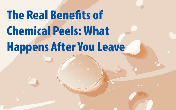 A chemical peel uses acids to lift away damaged surface cells and prompt renewal underneath — clearer skin, brighter tone, softer texture and, over a course, more collagen. The change most of my clients actually talk about isn't in the mirror on the day. It's the getting-ready time they get back, and how optional makeup starts to feel.